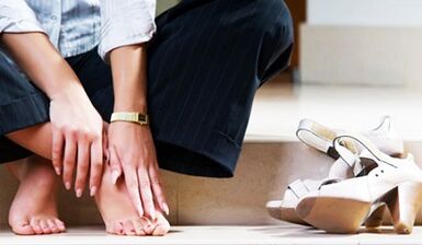 How varicose veins manifest on the legs